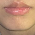 혹시 나 <b>무턱</b>에 턱 긴편임?