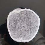 [도와주세요] 10개월 된 아이한테 조현병환자가 핸드폰을 던져 두개골함몰성골절이...