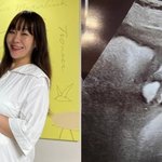 다섯째 子 출산 코앞…"3.8kg 돌파, 다음주 유도<b>분만</b> 상담"