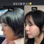 다이어트 후 확 달라진 얼굴 "같은 사람 맞냐고" [<b>MD</b>스타]