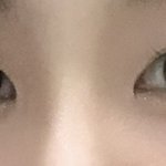 나 쌍수한지 3년 넘었는데 거의 속쌍됨