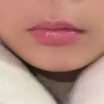 [드루와] 입술필러 맞고 시픈데