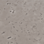 상처나면 <b>빨간약</b> 꼭 발라라