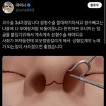 <b>코에</b> 외모정병 있는애들