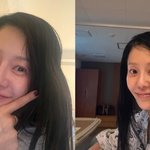 [단독]“큰수술 마쳤다” 고현정, 무사히 퇴원