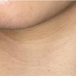 <b>목주름</b> 심하냐 ….