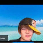 [드루와] 나 쌍수햇는데도 뭔가 <b>동태</b>느낌이 안없어짐