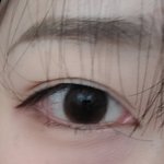 <b>쌍수</b>로 이렇게 가능?