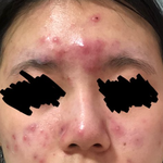 아니 이게 맞아?거울보고 ㅈㄴ우울해짐