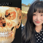 딸' 최준희, 남친 허락받았나? "양악수술 상담" [<b>MD</b>스타]