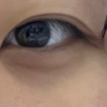 [댓글부탁해] 나 다크<b>서클</b> 개심함 진짜로