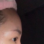 님들아 나 코<b>수술</b> 잘 됐지