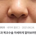 여자애들은 이 <b>코</b>가 ㅈㄴ많음ㅋㅋㅋㅋㄹㅇ