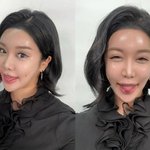 '부캐 부자' 랄랄, 성형외과 상담 하루 2000명... 돈방석...