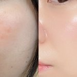 나 피부 많이 좋아<b>지지</b>않았어 ??