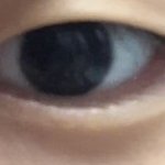 [댓글부탁해] 쌍수 해도 될까??