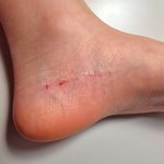 하..오늘 죽을뻔 한줄