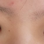 오늘 <b>쌍수</b>했는데 어때?