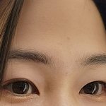 쌍수,<b>뒤밑</b>트임