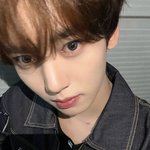 나 <b>이빨</b> 많이 심각해??