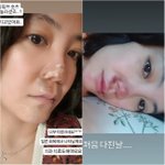 [종합] "코수술, 중형차값 들였는데"…고은아, 빙판에 대형...