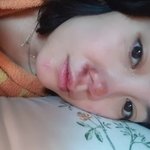 [드루와] 고은아, 코에 중형차 한 대 값 들었는데... 빙판길...