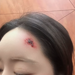 '38세' <b>홍수아</b>, 피투성이 된 얼굴…칼에 벤 듯한 자국까지