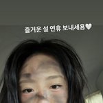 지예은 얼굴 무슨 일? 거무튀튀한 피부에 영혼 가출 표정.."즐거운...