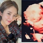 '이규혁' 손담비, 4월 출산 앞두고 <b>초음파</b> 사진 자랑 "누구 닮은...