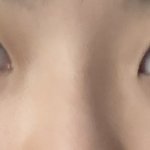 너가 내 코라면 코<b>수술</b>함?