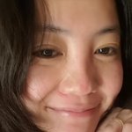 고은아, 안면부상 이후 근황 “많이 나아졌다…걱정 감사”