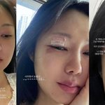'유상무' 김연지, 안타까운 소식…<b>피범벅</b> 눈가 "맞고 왔냐고"