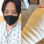 '카페 <b>CEO</b>' 노유민, 아찔한 사고..'찢어진 손'에 팬들 걱정↑