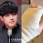 <b>NRG</b> 노유민, 설 연휴에 "손목 잘릴 뻔"→손 또 찢어짐....