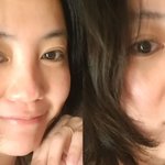 '코 3번 수술' 고은아 "얼굴 갈려...코 없어질 뻔"