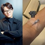 '이솔이' 박성광, 또 <b>수면</b> 마취.."올해만 벌써 세 번째"