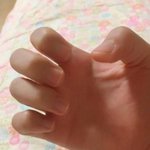 나 <b>손톱</b>모양정병있음