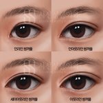 <b>후천</b>적 쌍꺼풀