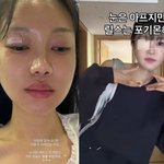 ‘유상무’ 김연지 피범벅 얼굴 극복<b>ing</b> “꾀병 끝, 아파도 릴스는...
