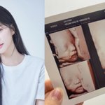 <b>해인</b>, 벌써 두 아이 엄마라니...둘째 입체초음파 자랑 "너무...