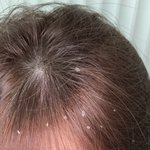 [하고싶은말] 린스 절대로 <b>두피</b>에 바르지마