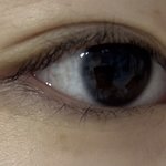 [댓글부탁해] 쌍수 한지 2년찬데 <b>티나</b>??