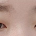 [댓글부탁해] 내 쌍수 전후 볼 사람