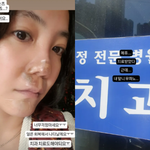 [댓글부탁해] '코 재수술' 고은아, 안면부상에 치과까지…"내...
