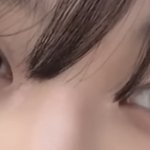 너네 이런 눈이면 <b>쌍수</b> 할거임??
