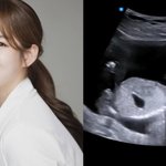 <b>김</b>도<b>빈</b>송문선, 결혼 7년만 임신 발표 “귀여운 아가가 찾아와”