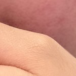 <b>홍조</b> 개심한데 어케함? ㄹㅈㄷ야