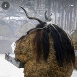 비만은 <b>머리털</b>이 많이 빠지나?