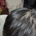 <b>탈모</b>인가요?