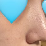 코 메<b>부리</b> 심함..?